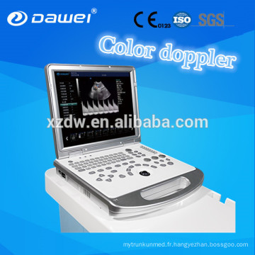 Reconditionné doppler couleur machine à ultrasons portable